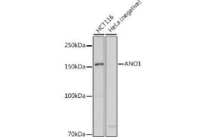 Western blot analysis of extracts of various cell lines, using  antibody (ABIN6129706, ABIN6136901, ABIN6136902 and ABIN6214776) at 1:1000 dilution. (ANO1 抗体  (AA 628-731))