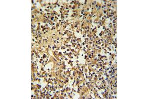 Immunohistochemistry (IHC) image for anti-Granzyme M (Lymphocyte Met-Ase 1) (GZMM) antibody (ABIN3002803) (GZMM 抗体)