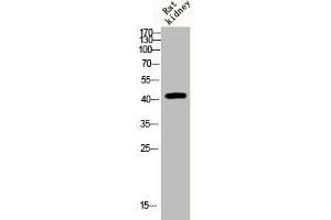 Western Blot analysis of Rat-kidney cells using Phospho-KOR-1 (S369) Polyclonal Antibody (OPRK1 抗体  (pSer369))