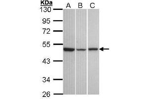 WB Image Sample (30 ug of whole cell lysate) A: A431 , B: Hela C: Hep G2 , 10% SDS PAGE antibody diluted at 1:1000 (KISS1R 抗体  (C-Term))