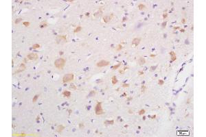 Formalin-fixed and paraffin embedded rat brain labeled with Anti GABRG2/GABA A Receptor gamma 2 Polyclonal Antibody, Unconjugated (ABIN754003) at 1:200 followed by conjugation to the secondary antibody and DAB staining