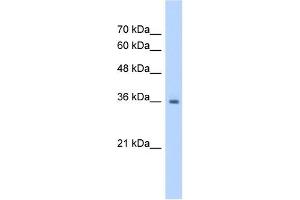 RSU1 antibody used at 1. (RSU1 抗体  (C-Term))