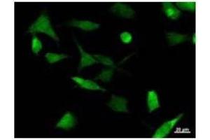 Immunostaining analysis in HeLa cells. (UBP1 抗体)