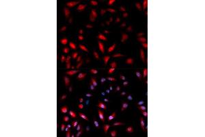 Immunofluorescence analysis of U2OS cell using Phospho-HSPB1-S82 antibody. (HSP27 抗体  (pSer82))