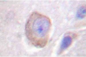 Image no. 1 for anti-Interleukin 3 Receptor, alpha (IL3RA) antibody (ABIN265478)