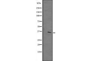 Western blot analysis of TTC19 expression in A431 whole cell lysate ,The lane on the left is treated with the antigen-specific peptide. (TTC19 抗体  (Internal Region))
