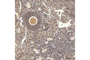 IHC analysis of U1A/SNRPA using anti-U1A/SNRPA antibody (ABIN7600891). (SNRPA1 抗体  (AA 25-218))
