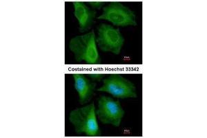 ICC/IF Image Immunofluorescence analysis of paraformaldehyde-fixed HeLa, using CacyBP, antibody at 1:200 dilution. (CACYBP 抗体  (C-Term))