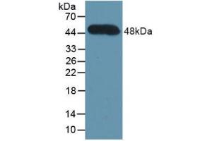 Western blot analysis of recombinant Human CFH. (Complement Factor H 抗体  (AA 860-1231))