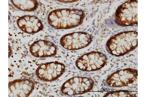 Immunoperoxidase of monoclonal antibody to HSPA2 on formalin-fixed paraffin-embedded human colon. (HSPA2 抗体  (AA 1-639))
