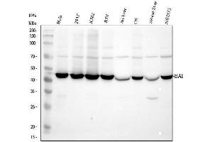 Western blot analysis of KAT1/HAT1 using anti-KAT1/HAT1 antibody (ABIN7603224).