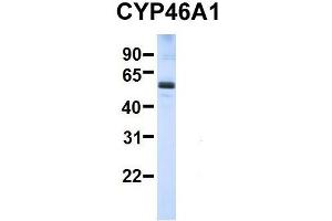 Host:  Rabbit  Target Name:  SERPINA3  Sample Type:  Human Adult Placenta  Antibody Dilution:  1. (CYP46A1 抗体  (C-Term))