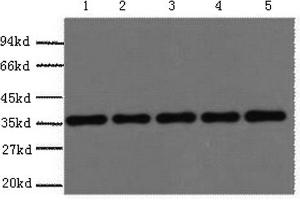 Western Blotting (WB) image for anti-Glyceraldehyde-3-Phosphate Dehydrogenase (GAPDH) antibody (ABIN5959504) (GAPDH 抗体)