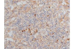 Immunohistochemistry (IHC) image for anti-Matrix Metallopeptidase 9 (Gelatinase B, 92kDa Gelatinase, 92kDa Type IV Collagenase) (MMP9) (C-Term) antibody (ABIN6263289)
