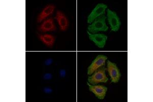 ABIN6260505 and ABIN6279264 staining Hela cells by IF/ICC. (CATSPER3 抗体  (Internal Region))