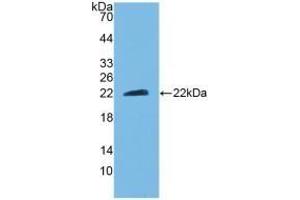 Detection of Recombinant CNTF, Mouse using Polyclonal Antibody to Ciliary Neurotrophic Factor (CNTF) (CNTF 抗体  (AA 2-198))