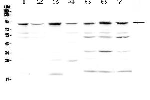 Western blot analysis of BAP1 using anti-BAP1 antibody . (BAP1 抗体  (AA 1-278))