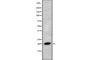 Western blot analysis of RNF5 using Jurkat whole cell lysates (RNF5 抗体  (C-Term))