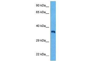 Host:  Rabbit  Target Name:  FOSL2  Sample Tissue:  Mouse Spleen  Antibody Dilution:  1ug/ml (FOSL2 抗体  (Middle Region))
