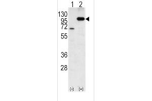 Western blot analysis of P (arrow) using rabbit polyclonal P Antibody (C-term) 6306b. (APP 抗体  (C-Term))