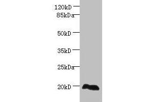 Western blot All lanes: EEF1E1 antibody at 2 μg/mL + HepG2 whole cell lysate Secondary Goat polyclonal to rabbit IgG at 1/10000 dilution Predicted band size: 20, 16 kDa Observed band size: 20 kDa (EEF1E1 抗体  (AA 2-174))