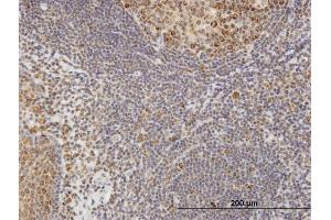 Immunostaining (ISt) image for anti-Collagen, Type IV, alpha 3 (Goodpasture Antigen) Binding Protein (COL4A3BP) (AA 1-598) antibody (ABIN948882)