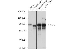 Western blot analysis of extracts of various cell lines, using MYEF2 antibody (ABIN7268721) at 1:1000 dilution. (MYEF2 抗体  (AA 1-120))