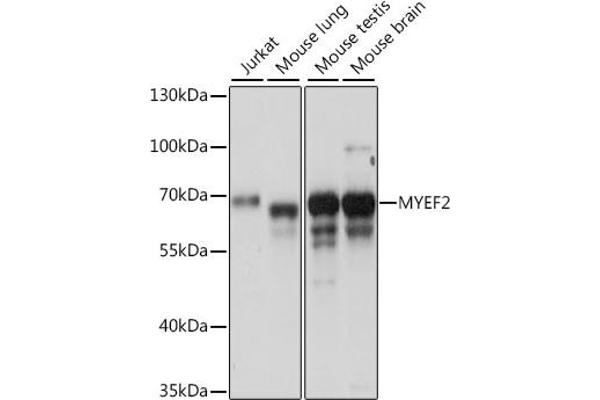 MYEF2 抗体  (AA 1-120)