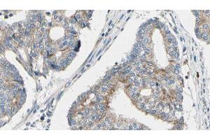 ABIN6276606 at 1/100 staining Human prostate tissue by IHC-P. (TPM3 抗体  (N-Term))