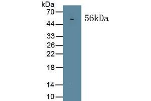 Detection of Recombinant MAPKAP1, Human using Polyclonal Antibody to Mitogen Activated Protein Kinase Associated Protein 1 (MAPKAP1) (MAPKAP1 抗体  (AA 8-236))