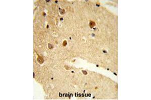 Formalin-fixed and paraffin-embedded human brain tissue reacted with CNDP1 Antibody (C-term), which was peroxidase-conjugated to the secondary antibody, followed by DAB staining. (CNDP1 抗体  (C-Term))