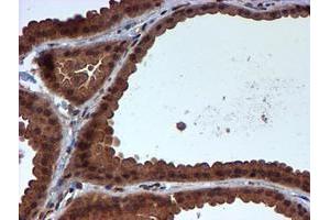 Immunohistochemical staining of paraffin-embedded Human breast tissue using anti-HARS2 mouse monoclonal antibody. (HARS2 抗体)