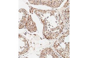 Immunohistochemical analysis of paraffin-embedded human testis tissue using B performed on the Leica® BOND RXm. (STRA8 抗体  (C-Term))