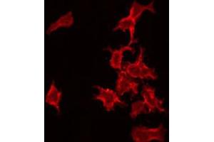 ABIN6272367 staining COLO205 by IF/ICC. (NRIP3 抗体  (C-Term))