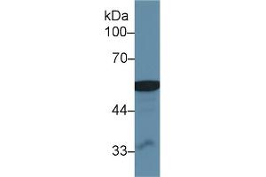 Western Blot; Sample: Human Liver lysate; Primary Ab: 1µg/ml Rabbit Anti-Human ALDM Antibody Second Ab: 0. (ALDH2 抗体  (AA 59-150))