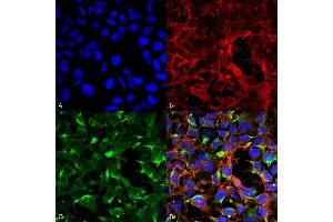Immunocytochemistry/Immunofluorescence analysis using Mouse Anti-Dityrosine Monoclonal Antibody, Clone 7D4 (ABIN5067452). (Dityrosine 抗体  (Atto 390))