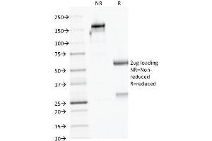 SDS-PAGE Analysis Purified AMACR / p504S Mouse Monoclonal Antibody (AMACR/1723). (AMACR 抗体)