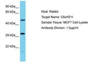 Image no. 1 for anti-ARMT1 (AA 102-151) antibody (ABIN6750670) (ARMT1 (AA 102-151) 抗体)