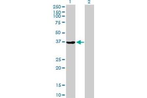 Western Blot analysis of AKR1A1 expression in transfected 293T cell line by AKR1A1 MaxPab polyclonal antibody. (AKR1A1 抗体  (AA 1-325))