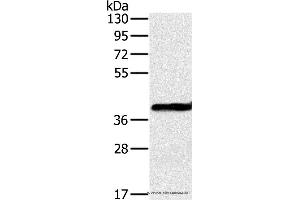 Western blot analysis of Mouse liver tissue, using OTC Polyclonal Antibody at dilution of 1:650 (OTC 抗体)