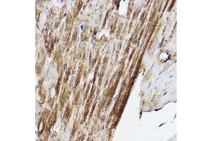 Immunohistochemistry of paraffin-embedded mouse heart using PLOD3 Rabbit pAb (ABIN6130652, ABIN6145791, ABIN6145792 and ABIN6214834) at dilution of 1:50 (40x lens). (PLOD3 抗体  (AA 25-280))