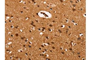 The image on the left is immunohistochemistry of paraffin-embedded Human brain tissue using ABIN7190032(CABLES2 Antibody) at dilution 1/25, on the right is treated with synthetic peptide. (CABLES2 抗体)