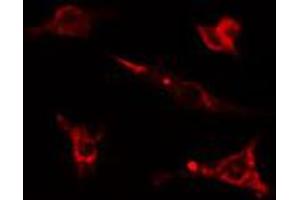 ABIN6274588 staining Hela cells by IF/ICC. (beta Arrestin 1 抗体  (C-Term))