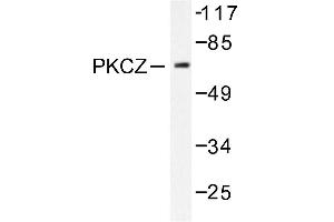 Image no. 1 for anti-Protein Kinase C, zeta (PRKCZ) antibody (ABIN271785) (PKC zeta 抗体)