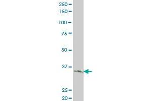 LDB3 monoclonal antibody (M06), clone 3C8 Western Blot analysis of LDB3 expression in A-431 . (LIM Domain Binding 3 Protein 抗体  (AA 1-283))
