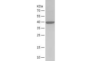 Western Blotting (WB) image for Calreticulin (CALR) (AA 25-199) protein (His-IF2DI Tag) (ABIN7122109) (Calreticulin Protein (CALR) (AA 25-199) (His-IF2DI Tag))