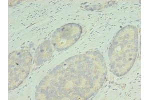 Immunohistochemistry (IHC) image for anti-Retinol Dehydrogenase 12 (All-Trans/9-Cis/11-Cis) (RDH12) (AA 1-316) antibody (ABIN7167836)