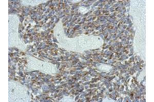 IHC-P Image Immunohistochemical analysis of paraffin-embedded BT483 xenograft, using KCNG4, antibody at 1:500 dilution. (KCNG4 抗体  (Center))