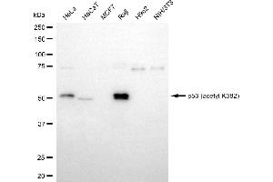 Western blotting analysis using p53 (acetyl K382) antibody (ABIN7800683). (Recombinant p53 抗体  (acLys382))