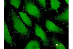 Immunofluorescence of purified MaxPab antibody to PDZRN4 on HeLa cell. (PDZRN4 抗体  (AA 1-778))